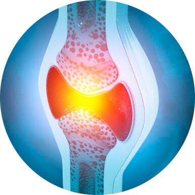 processus de restauration articulaire avec le gel Icexin